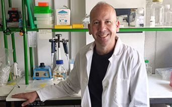 Amiloidosi, intervista a Matteo Floris