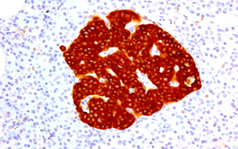 Isole pancreatiche