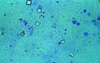 Cristalli di ossalato